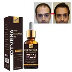 Hair Growth Oil Manufacturer - OEM Natural Moisturizing Anti Hair Loss