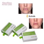 Anti Wrinkle Powder Manufacturer - Custom Natural Professional Lyophilized