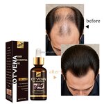 Hair Growth Oil Manufacturer - Organic Fast Hair Loss Treatment
