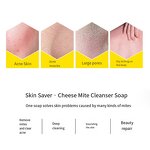 Cheese Anti Mite Soap Factory - OEM Solving Oil Skin Problems