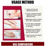 Counterpain Body Cream Supplier - OEM OEM Perfectx Joint Bone Valgus