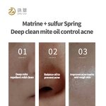 Anti-mite Soap Supplier - OEM Control Oil Eliminate Acne Moist