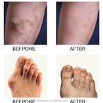 Sports Injury Cream Factory - OEM Wholesale Bulk Joint Pain Relief