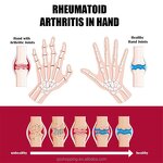 Joint Care Cream Manufacturer - OEM New Arrival Perfectx Cartilage Repair