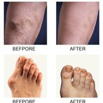 Counterpain Body Cream Supplier - OEM OEM Perfectx Joint Bone Valgus