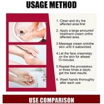 Sports Injury Cream Factory - OEM Wholesale Bulk Joint Pain Relief