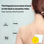 Anti-mite Soap Manufacturer - OEM Moisturize Additive Plant Extraction