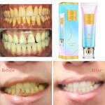 Niacinamide Toothpaste Factory - OEM Advanced Oral Care Herbal Mint