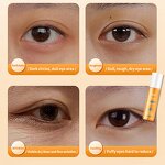 Eye Serum Essence Supplier - OEM Hot Sale Multi-functional Massage