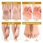 Papaya Foot Mask Supplier - OEM Natural Papaya Honey Moisturizing