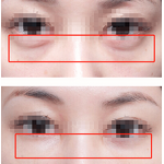 PDRN Firming Eye Cream Manufacturer - OEM Korean Cosmetic Remove Fine