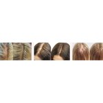 Scalp Serum Manufacturer - OEM Hair Growth Serum for Men Private