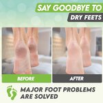 Peel Foot Mask Factory - OEM Green Tea Moisturizing Glycolic Acid