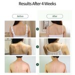 Tea Tree Body Wash Factory - OEM OEM ODM Antifungal Body Wash