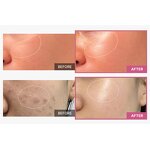 Polypeptide Collagen Cream Factory - OEM Polypeptide Collagen Glycerin PDRN