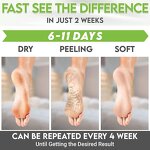 Exfoliation Peel Foot Mask Factory - OEM Green Tea Moisturizing Glycolic