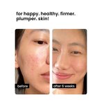 Blue Copper Peptide Serum Manufacturer - OEM Private Label Natural Skin Care