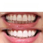 Whitening Toothpaste Factory - OEM Vanilla Mint Removes Stains