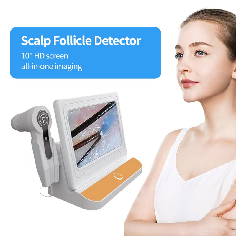 Scalp Analyzer Supplier - 2024 New OEM Dermatology Mobile UV Camera