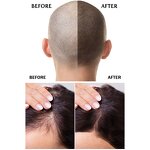 Hair Shampoo Manufacturer - Professional Custom Korean Keratin Fast Growth