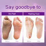 Foot Care Mask Factory - Foot Treatment Dead Skin Heat Mask