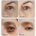 Eye Mask Manufacturer - Private Label Anti-wrinkle Moisturizing Dark Circles