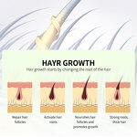 Hair Growth Oil Factory - Wholesale Best Selling Vitamins Rosemary Fast