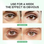 Under Eye Patch Manufacturer - Custom Private Label Collagen Hydrogel