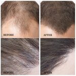 Hair Regrowth Oil Manufacturer - Create Your Own Brand Natural Organic