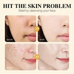 Face Cleansing Gel Factory - Organic Whitening Amino Acid Moisturizing