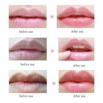 Lip Patch Mask Supplier - Wholesale Hydrogel Moisturizing Collagen Plumping