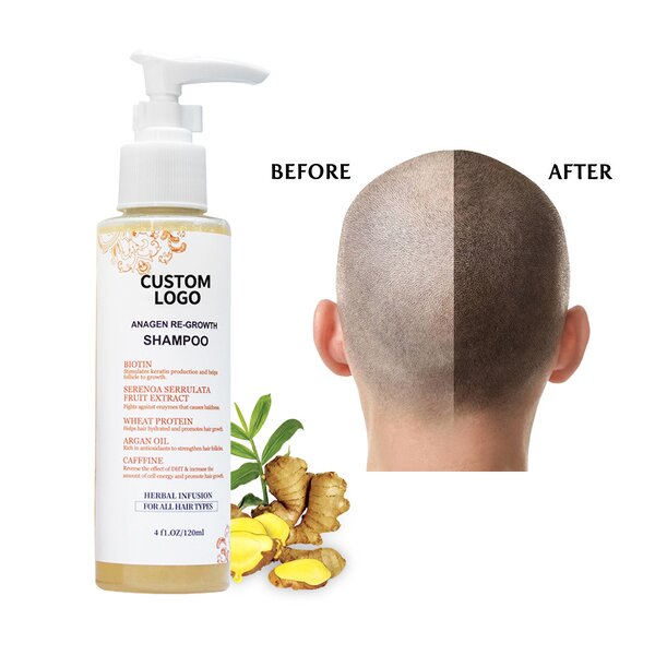 Shampoo Manufacturer - Free Sample OEM No Sulphate Turmeric Hotel Hair Care
