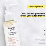 Hairloss Shampoo Supplier - 100% Organic Gentle Anti Itch Anti-dandruff