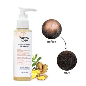 Hairloss Shampoo Supplier - 100% Organic Gentle Anti Itch Anti-dandruff
