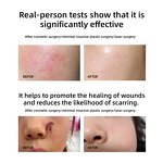 Vegan Anti Wrinkle Serum Manufacturer - OEM Private Label Nourishing Hyaluronic