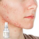 Collagen Healing Patch Gel Factory - OEM Small Cut Wound Laser Postoperative