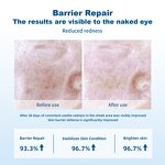 Recombinant Collagen Face Spray Manufacturer - OEM Soothing Lifting Damaged Barrier