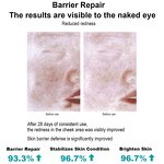 Medical Collagen Gel Factory - OEM Skincare After Laser Plastic Surgery