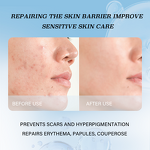 Non-irritating Repair Mask Supplier - OEM Hypoallergenic Hydrating Moisturizing