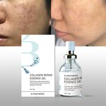 Anti-acne Repair Gel Supplier - OEM High Quality Hydrating Nourish