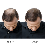 Hair Growth Oil Supplier - Ginger Hair Thickening Products Natural Care