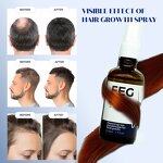 Hair Growth Serum Factory - Private Label Anti Loss Thicken Regrowth Spray