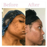 Turmeric Skin Toner Manufacturer - OEM Private Label OEM Natural Organic