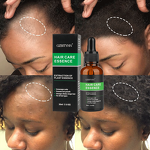 Ginger Hair Growth Oil Supplier - OEM Private Label Natural Organic