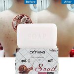 Snail Whitening Soap Factory - OEM Wholesale New Products Acne
