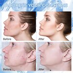 PDRN Salmon DNA Serum Supplier - OEM OEM Hyaluronic Acid Whitening