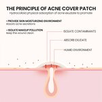 Hydrocolloid Acne Patch Factory - OEM Waterproof Custom Star Pimple