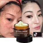 Freckle Cream Manufacturer - OEM High Quality Anti Wrinkle Dark