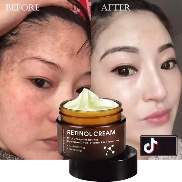 Freckle Cream Manufacturer - OEM High Quality Anti Wrinkle Dark