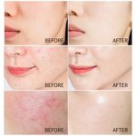 Rice Water Toner Supplier - OEM Private Label Natural Organic Skin